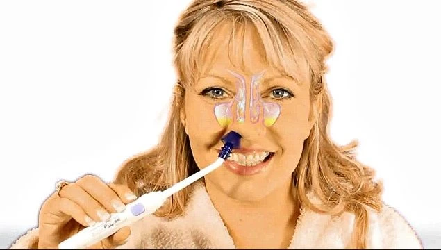 SinuPulse Elite Nasal Irrigation System 4 SinuPulse Elite Nasal Irrigation System - Image 4